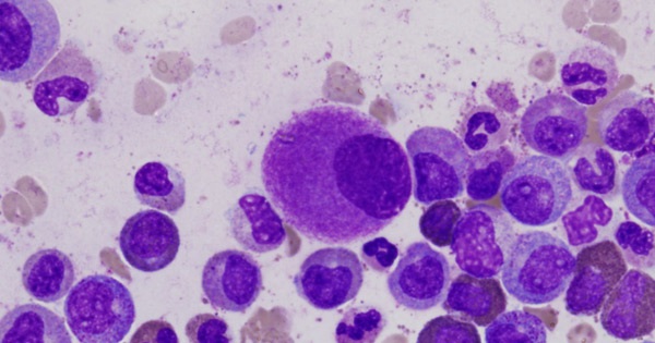 leukemia