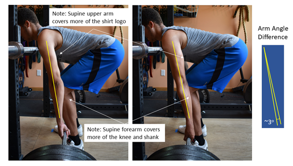 effect on the supine grip on arm angle