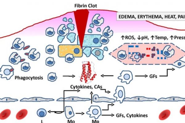 inflammation schematic