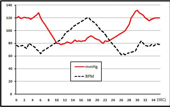 systolic blood pressure valsalva