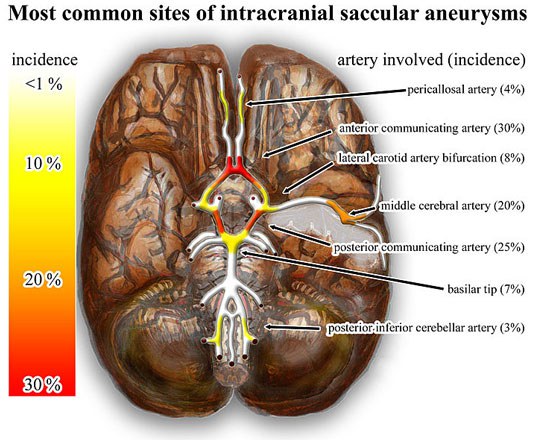 The Circle of Willis