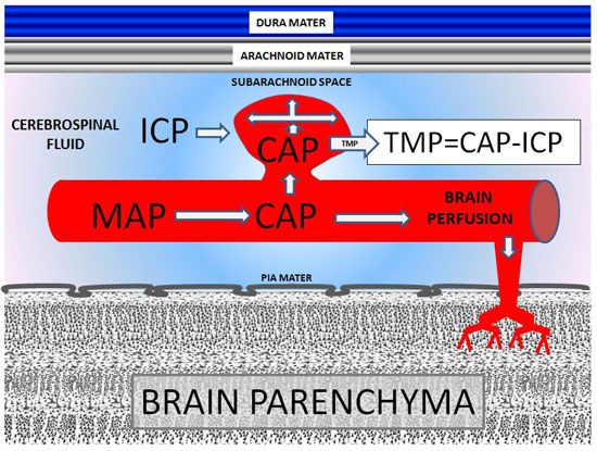  Hemodynamics and anatomy of aneurysm rupture