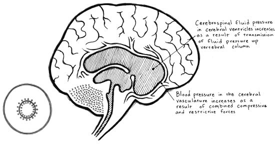 vascular protection mechanism