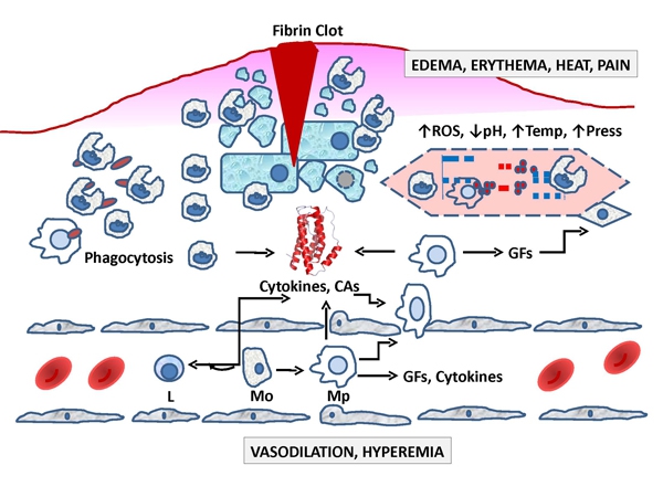 developed inflammatory response 